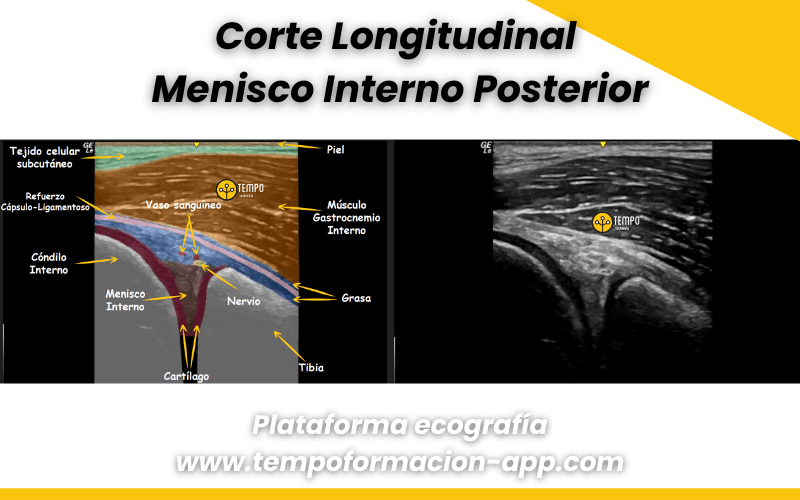 5. Ecografia tempo formacion rodilla.png